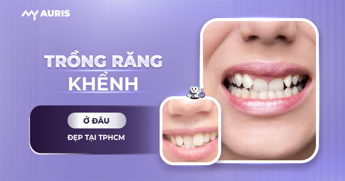 trồng răng khểnh ở đâu,trồng răng khểnh ở đâu tại tphcm,trồng răng khểnh ở tphcm