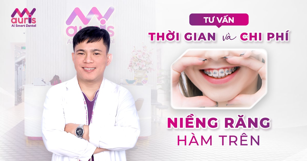 [TƯ VẤN] Chi phí và thời gian niềng răng hàm trên?