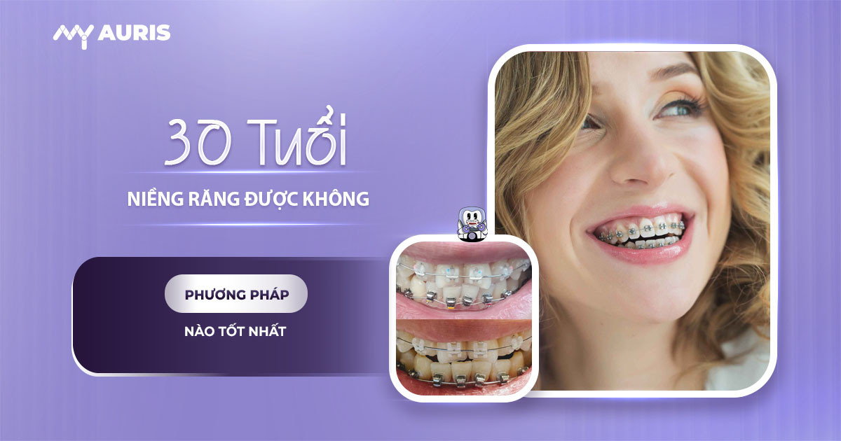 30 tuổi niềng răng mất bao lâu