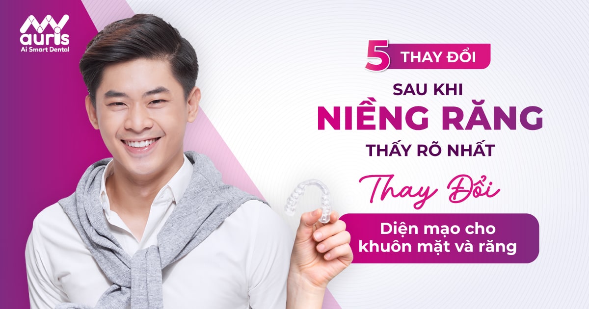 5 thay đổi sau khi niềng răng thấy rõ nhất