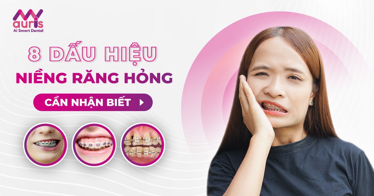 8 dấu hiệu niềng răng hỏng cần nhận biết