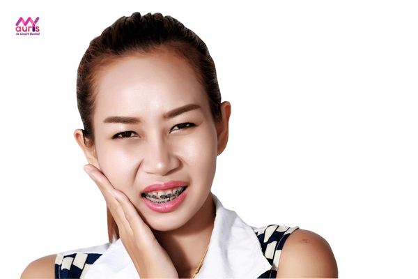 Niềng răng sai kỹ thuật cũng gây đau buốt sau khi niềng răng