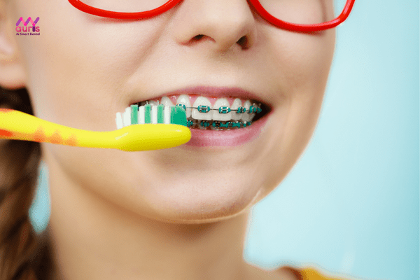 Vệ sinh răng miệng không đúng cách gây đau buốt sau khi niềng răng 