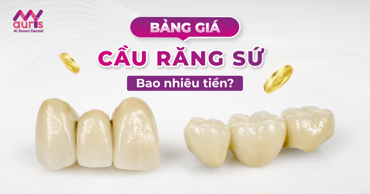 bảng giá cầu răng sứ