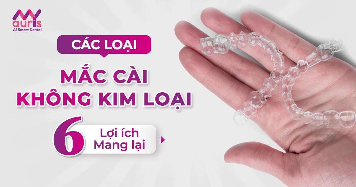 các loại niềng răng không mắc cài