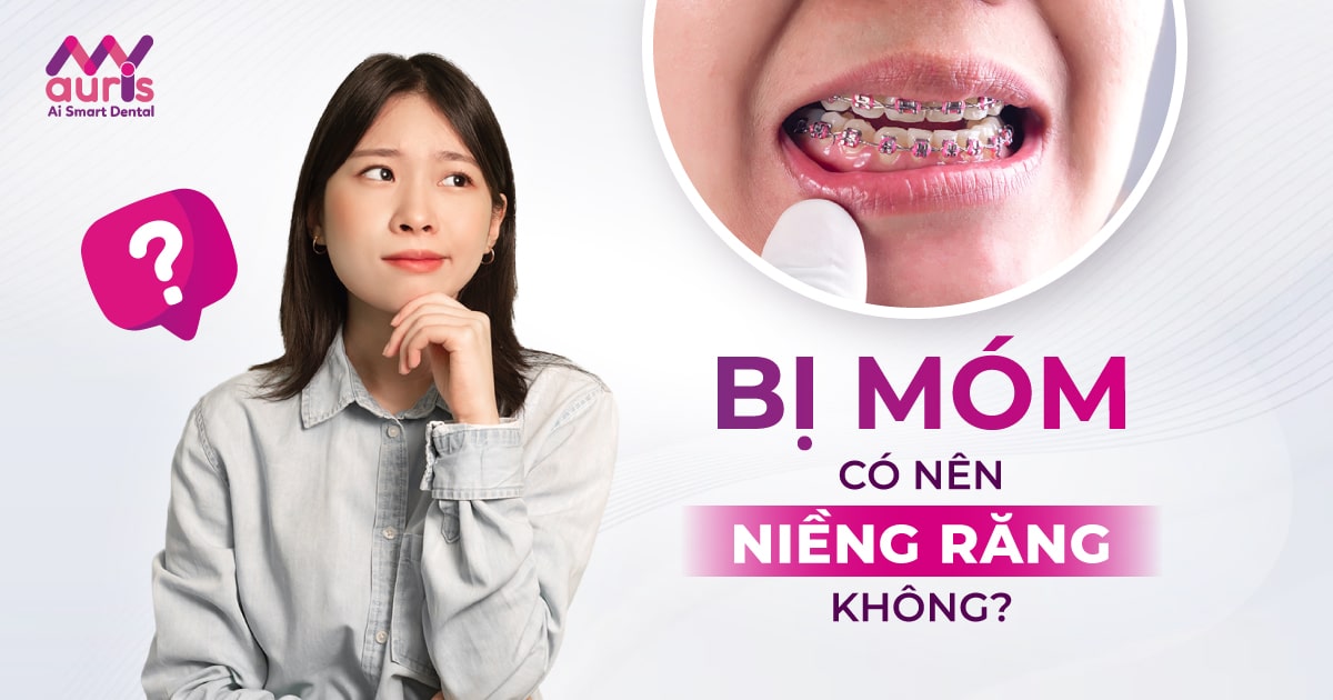 bị móm có nên niềng răng