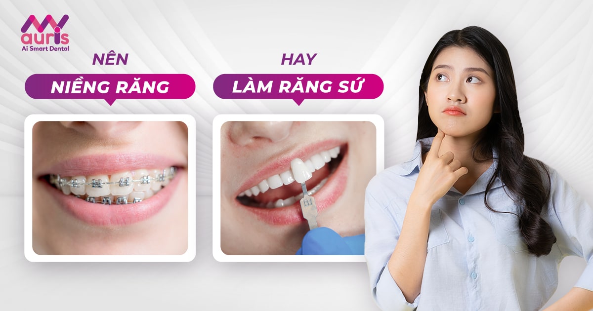 nên niềng răng hay làm răng sứ