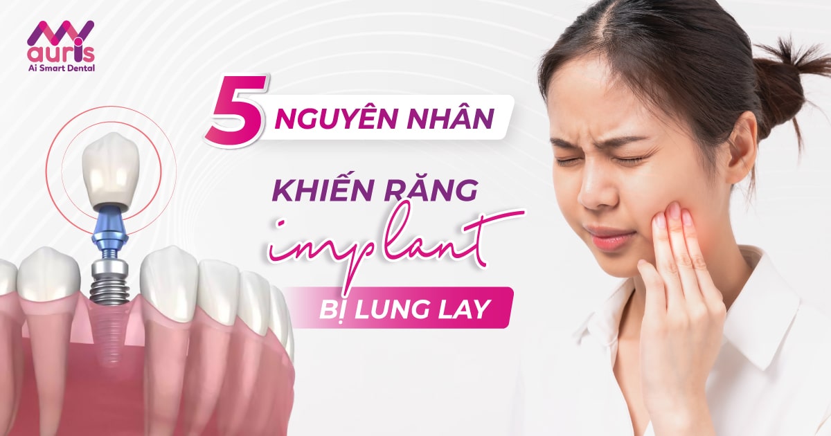 răng cắm implant bị lung lay