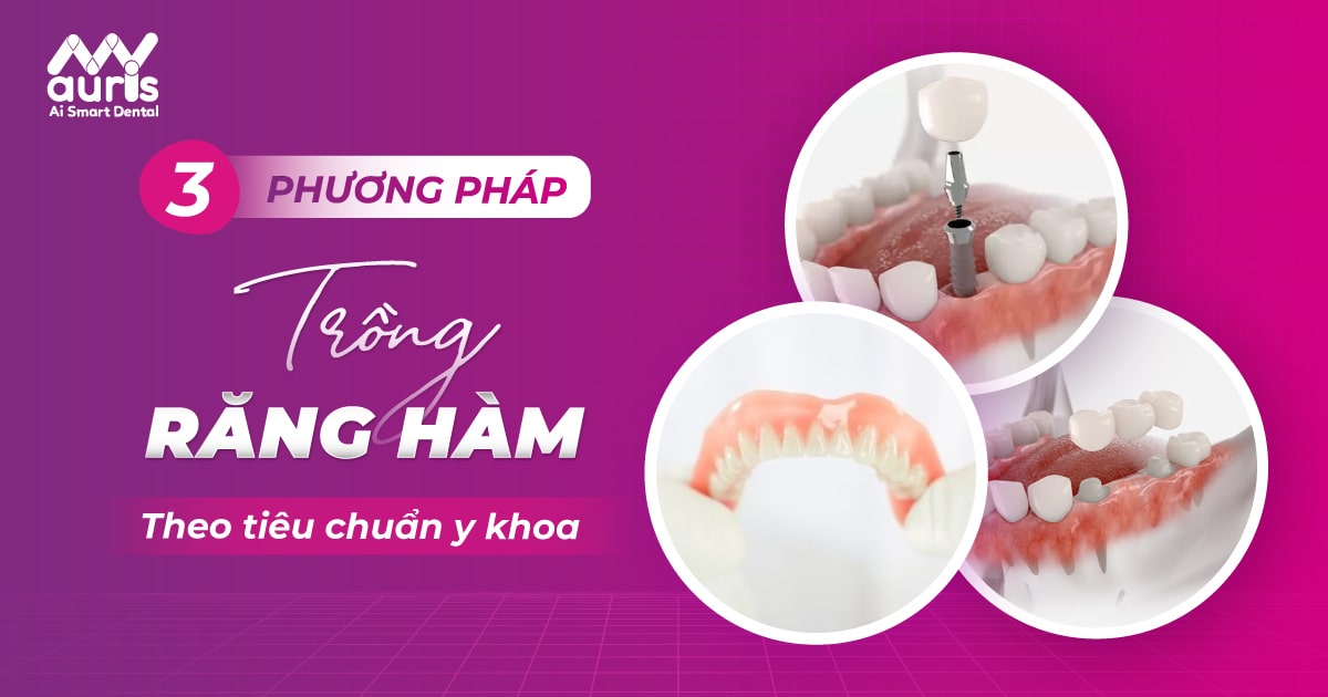 phương pháp trồng răng hàm tphcm