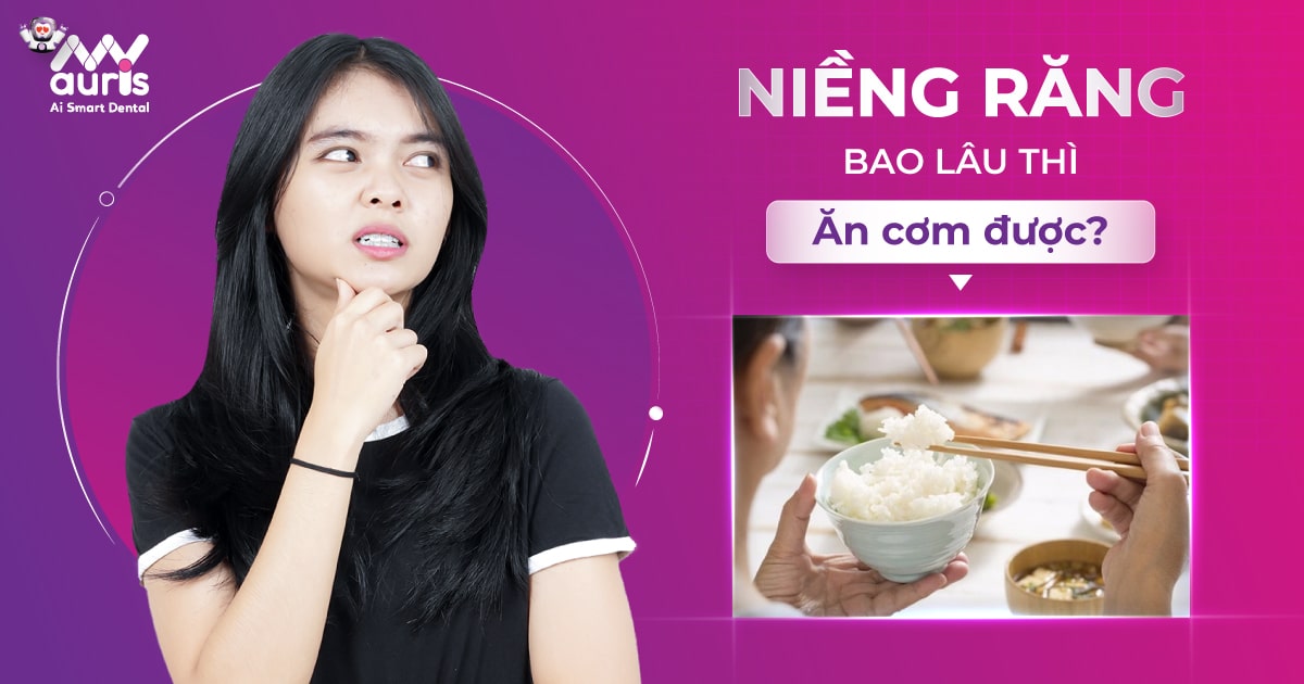 niềng răng bao lâu thì ăn được cơm