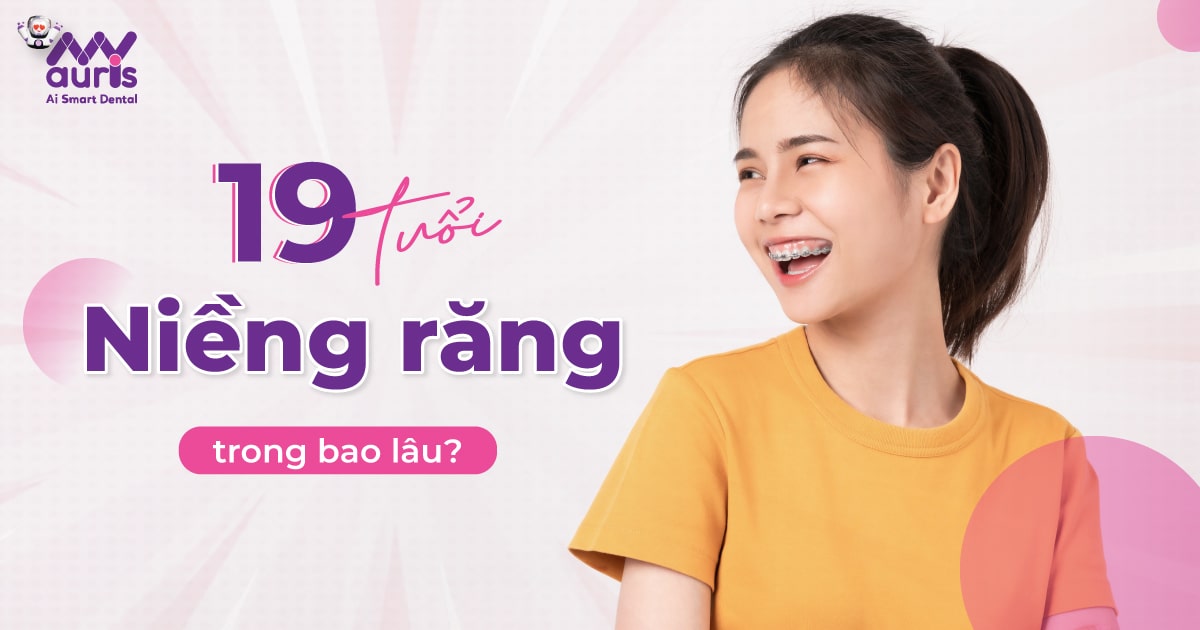 19 tuổi niềng răng bao lâu