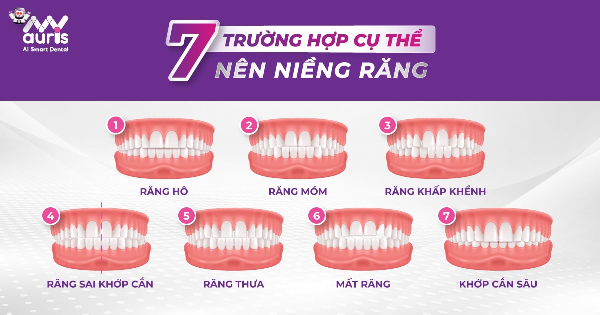 răng như thế nào thì nên niềng