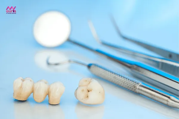 Thân răng bị nhiễm trùng hay bị sâu nên bọc răng sứ mới 