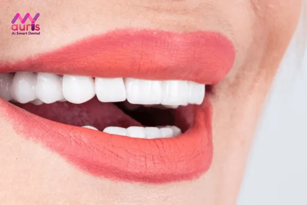 Hướng dẫn cách chăm sóc răng miệng sau khi bọc răng sứ