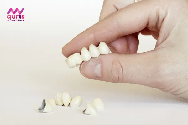 Dòng răng sứ nào có độ bền cao nhất?