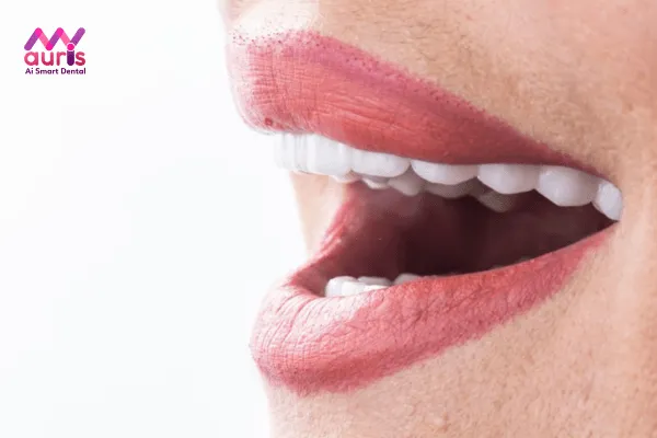 Tìm hiểu bọc răng sứ thời gian được bao lâu có thể hoàn thành?