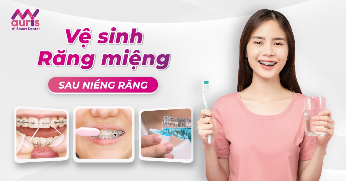 Vệ sinh răng miệng sau khi niềng răng - 6 điểm cần biết