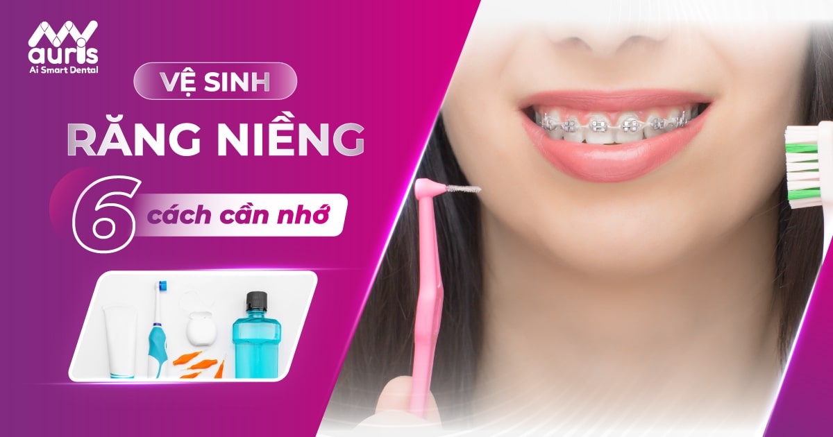 6 cách vệ sinh răng niềng và một số lưu ý cần biết