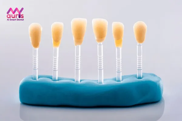 Thực hiện phủ răng sứ nano có thể mang lại những ưu điểm gì?