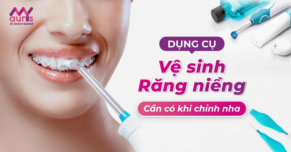 Top 5 dụng cụ vệ sinh răng niềng cần có khi chỉnh nha