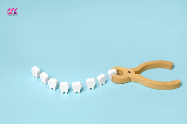 Răng khôn mọc trong quá trình chỉnh nha có cần nhổ không? 