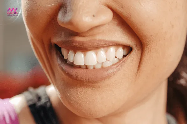 Ảnh hưởng của hàm răng đến khuôn mặt như thế nào? 