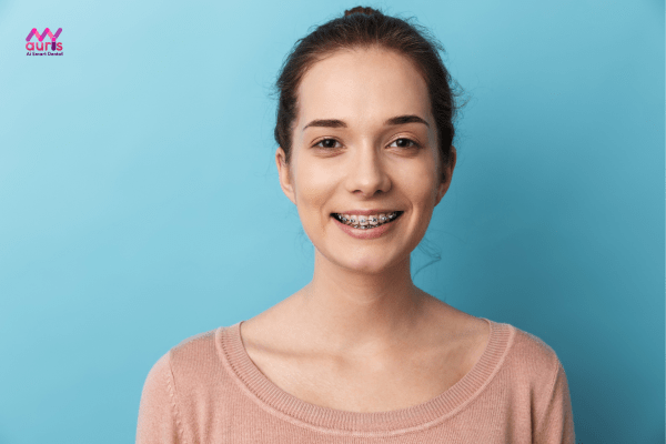 Khuôn mặt sau khi niềng răng thay đổi như thế nào? 
