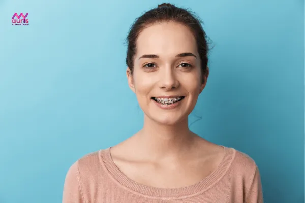 Khuôn mặt sau khi niềng răng thay đổi như thế nào? 