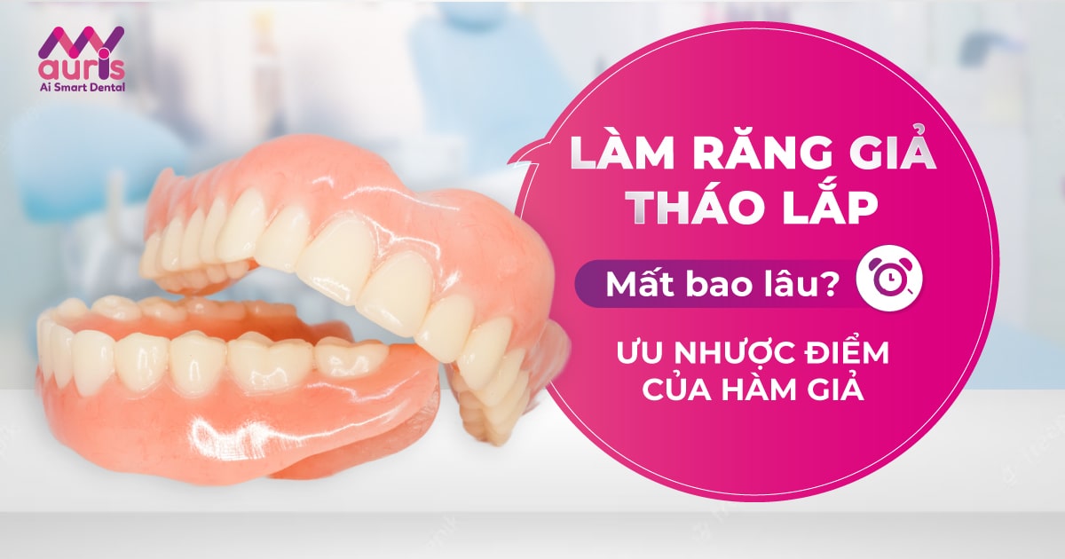 Làm răng giả tháo lắp mất bao lâu