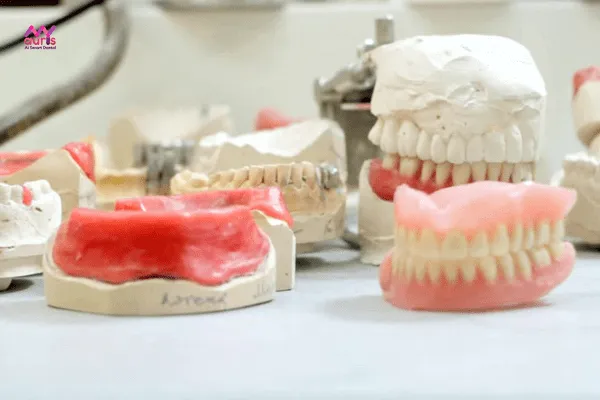 Nhổ răng bao lâu thì trồng hàm giả tháo lắp? 