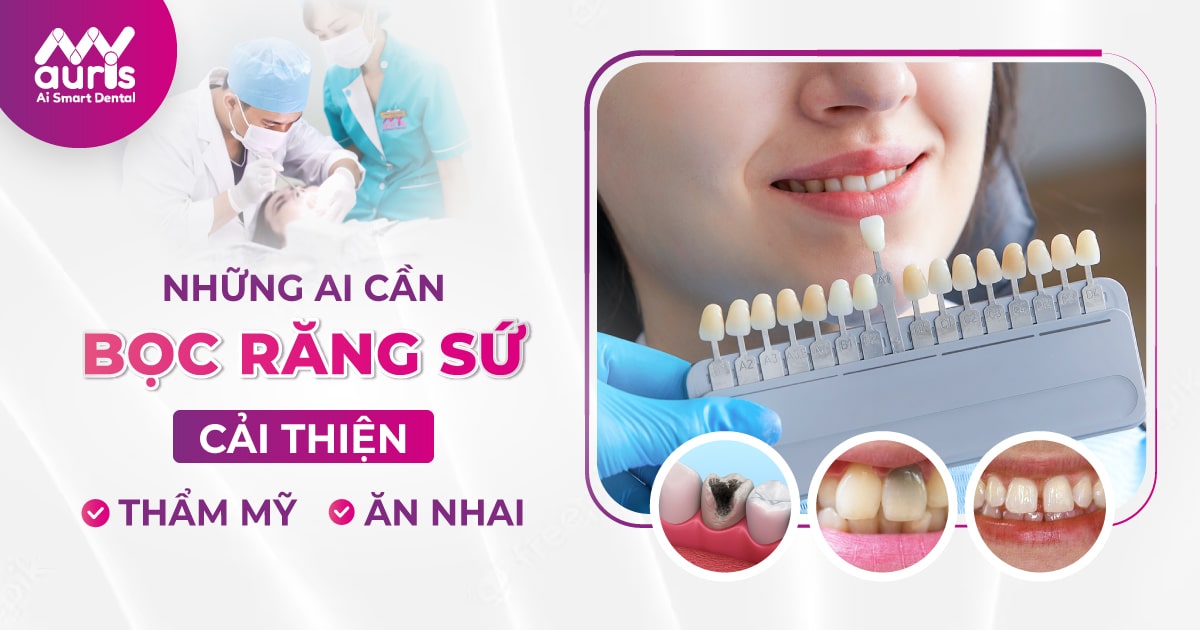 Những ai cần bọc răng sứ