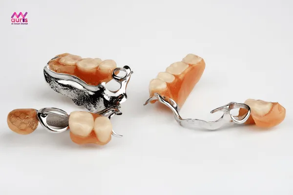 Hàm tháo lắp - những phương pháp trồng răng giả 
