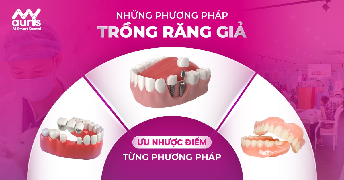 Những phương pháp trồng răng giả