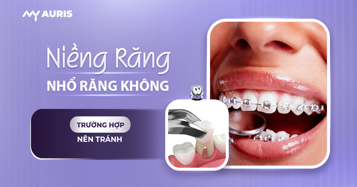 nieng-rang-co-nen-nho-rang-khong-260625-01