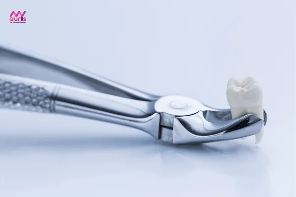 Mục đích của nhổ răng trong chỉnh nha