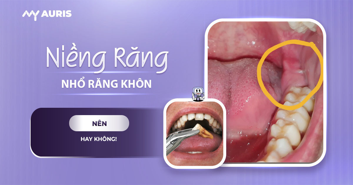 niềng răng có cần phải nhổ răng khôn không,niềng răng có phải nhổ răng số 8 không