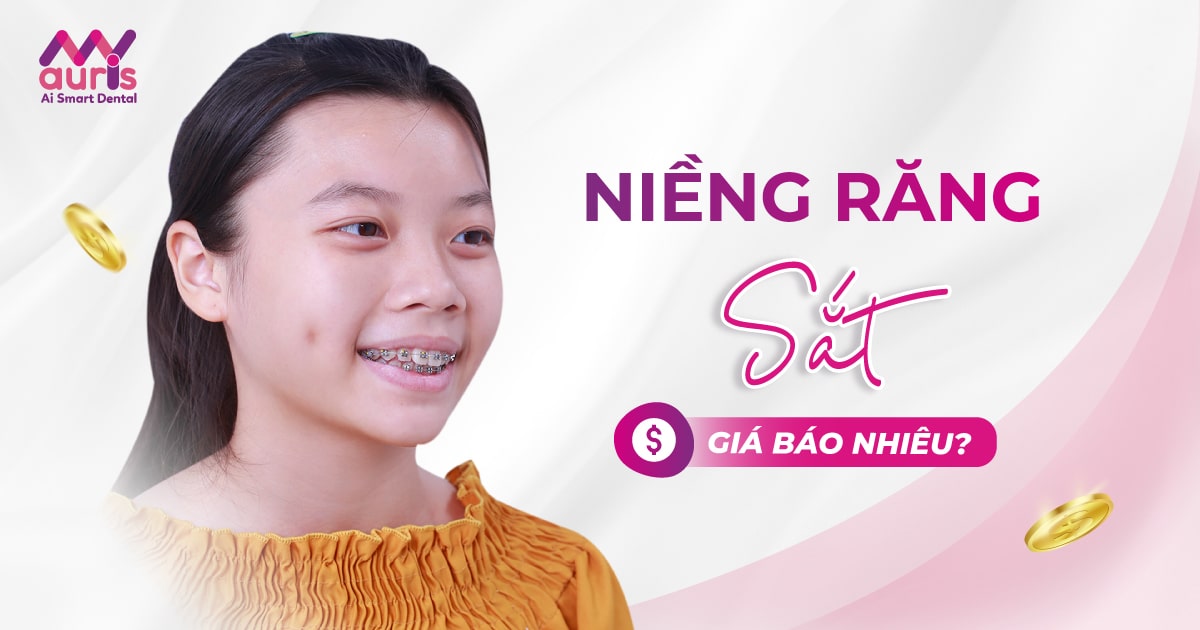 Niềng răng sắt giá bao nhiêu tiền? 4 trường hợp nên làm