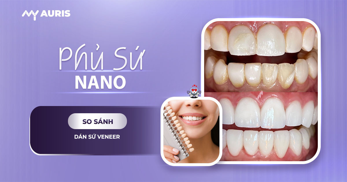 phủ sứ nano,phủ sứ nano cho răng có tốt không