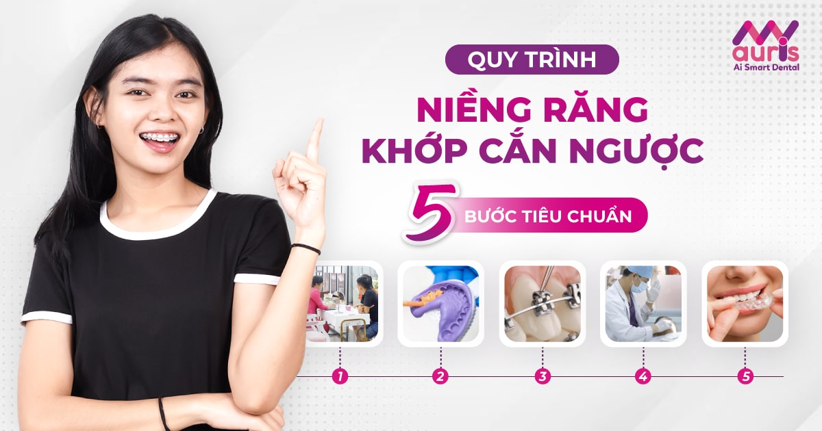 Quy trình niềng răng khớp cắn ngược