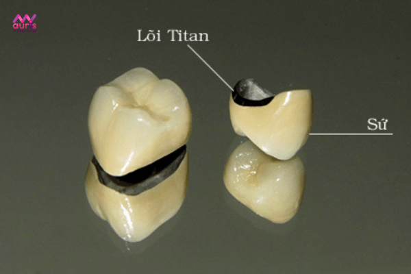Chất liệu răng sứ - Tiêu chí tác động răng bọc sứ giá bao nhiêu