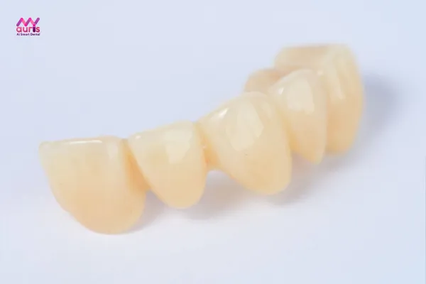 Răng sứ ceramill giá bao nhiêu?