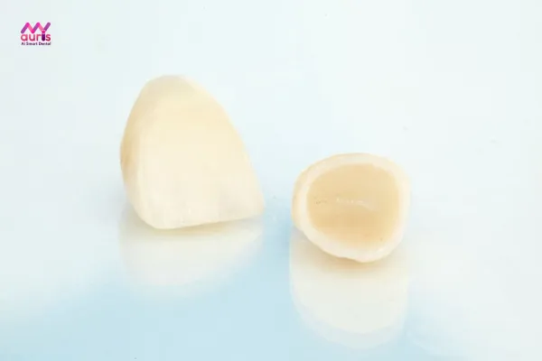 Răng sứ ceramill có tốt không? Có nên thực hiện không? 