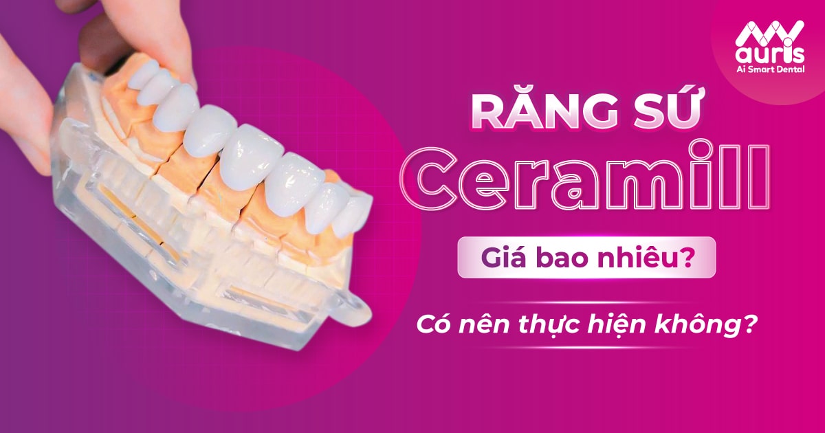 Răng sứ ceramill giá bao nhiêu?