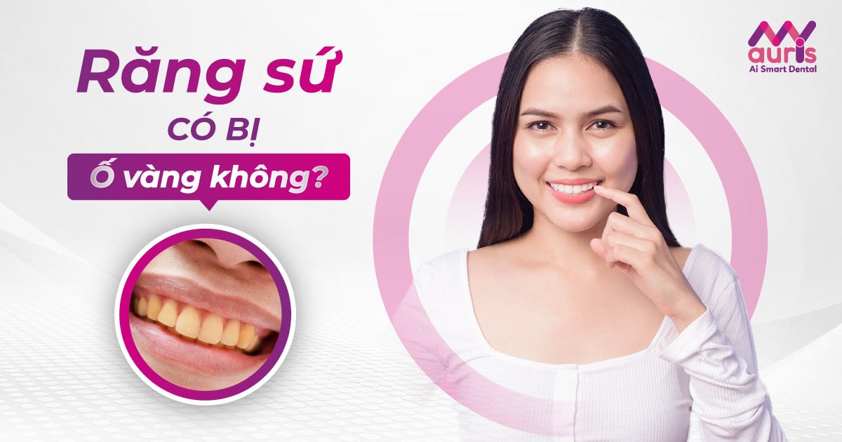 Răng sứ có bị ố vàng không? (Có 4 nguyên nhân chính)