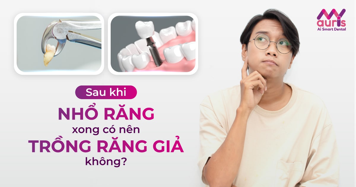 Sau khi nhổ răng xong có nên trồng răng giả không?