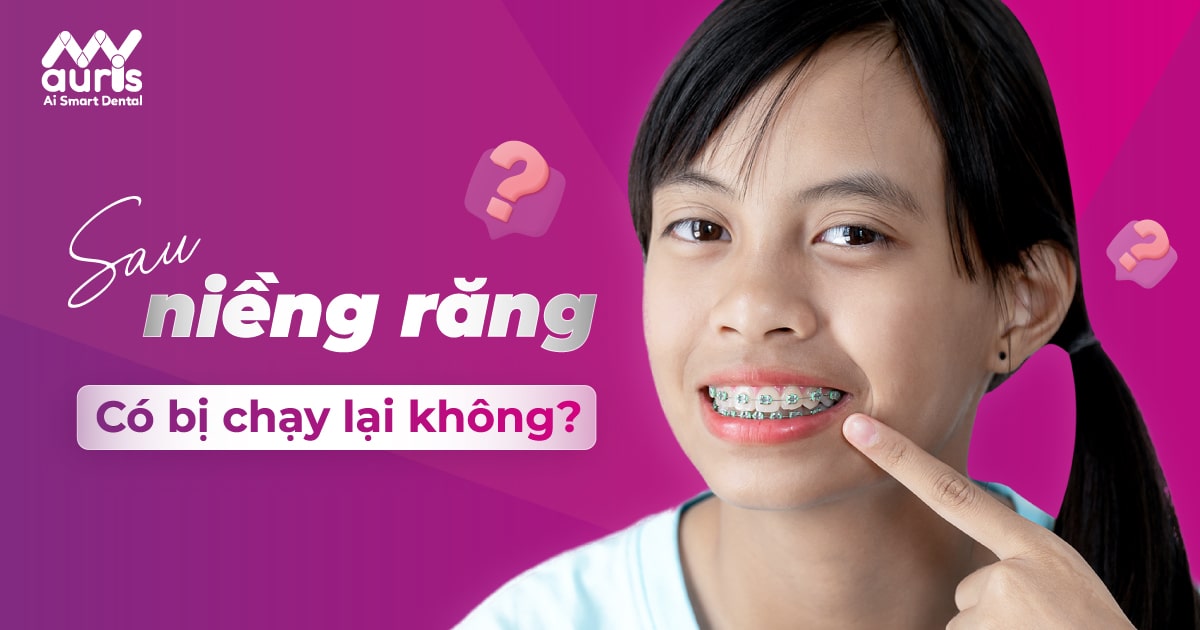 Sau khi niềng răng có bị chạy lại không? (3 lý do chính)