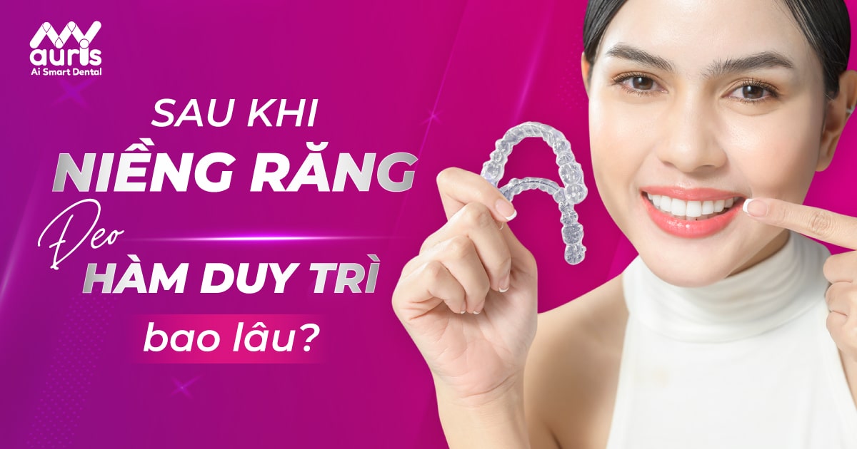 Sau khi niềng răng đeo hàm duy trì bao lâu? (2 loại chính)