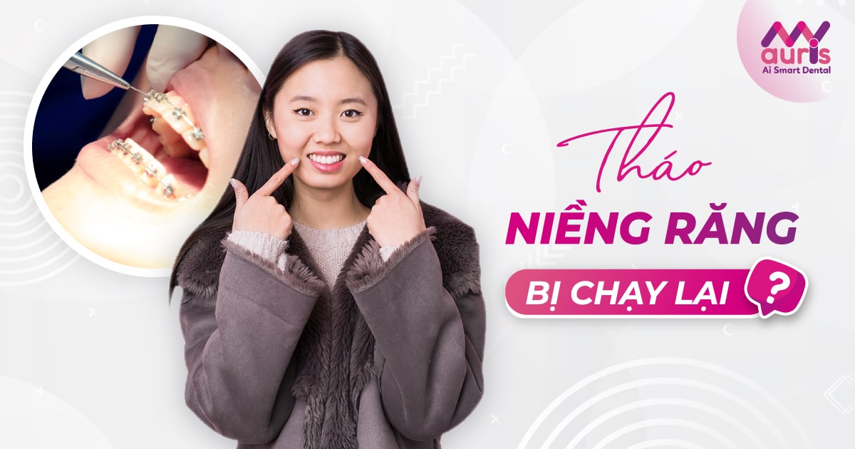 Tháo niềng răng bị chạy lại - Bắt nguồn từ 2 nguyên nhân