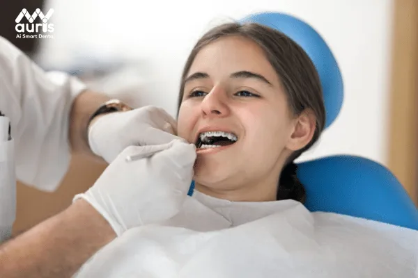 4 lưu ý cần nhớ khi thực hiện tháo niềng răng sớm