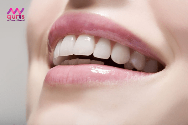 Mức độ thay đổi khuôn mặt sau niềng răng theo từng đối tượng